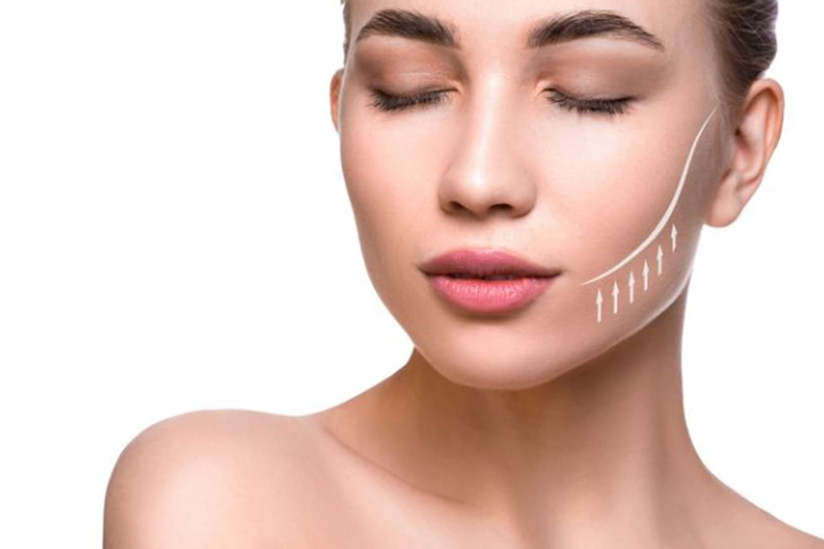 Lineリフト(糸リフト)