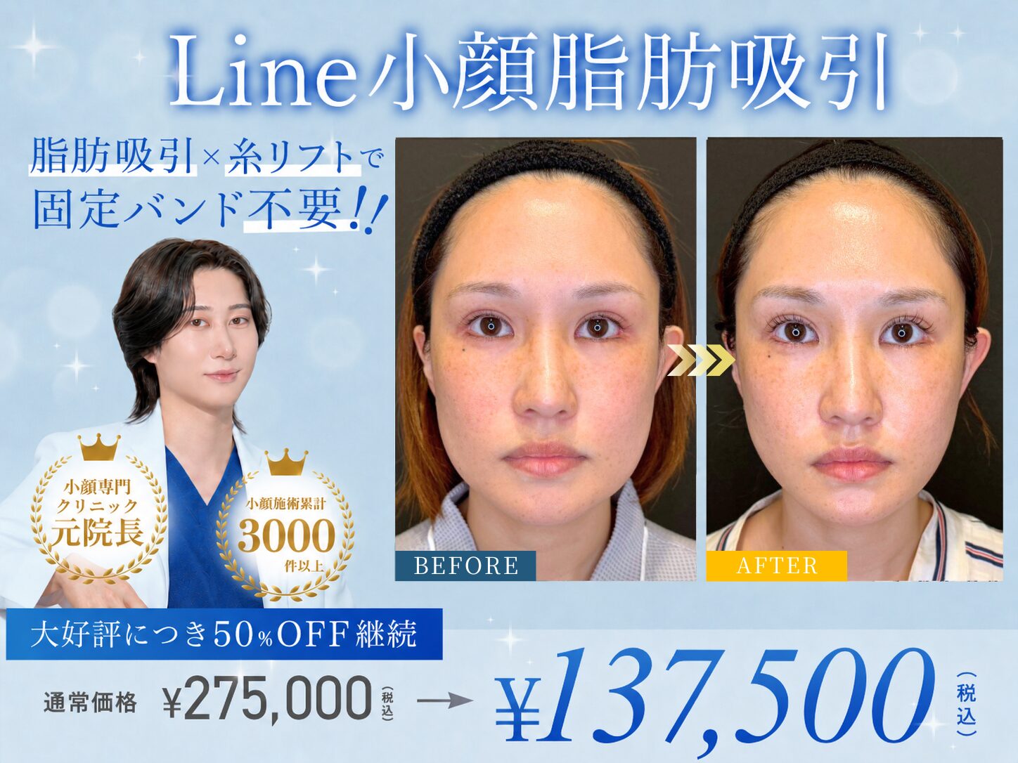 Line小顔脂肪吸引キャンペーン